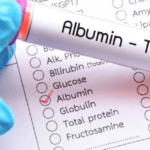 albumīns